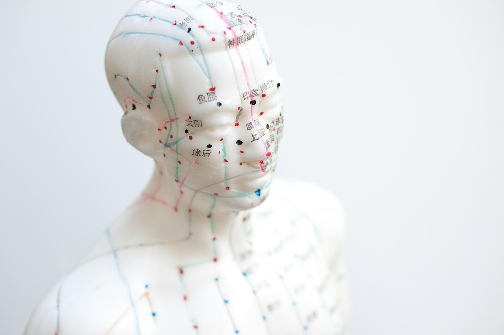 Therapieen, Acupunctuur, Chinese kruiden